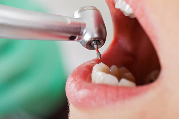 Best Emergency Dentist for Lost Fillings or Crowns in Mono Vista, CA